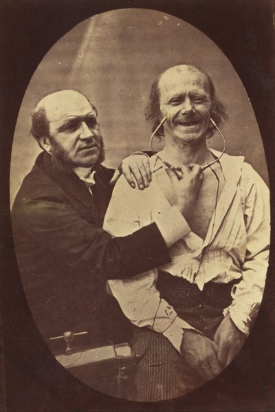 Mechanisme van de menselijke fysiognomie of elektro-fysiologische analyse van de expressie van de passies door Guillaume Benjamin Armand Duchenne de Boulogne
